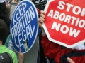 미국 낙태법, 한국보다 낫다고?